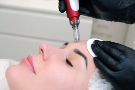 facial mesotherapy