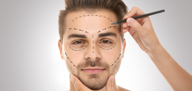 Un hombre con la cara marcada para cirugía plástica